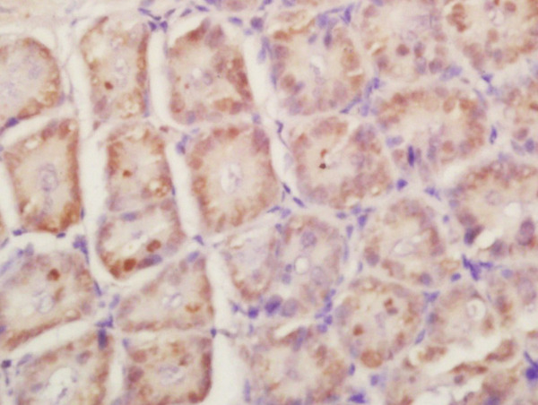 Formalin-fixed and paraffin embedded mouse intestine labeled with Anti-RPLP0 Polyclonal Antibody, Unconjugated (bs-1464R) at 1:200 followed by conjugation to the secondary antibody and DAB staining\n