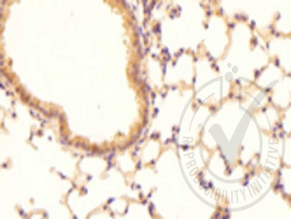 Image provided by the Independent Validation Program,badge number 029589:Formalin-fixed and paraffin embedded mouse lung labeled with Anti-CD142 Polyclonal Antibody, Unconjugated (bs-4690R) at 1:200 followed by conjugation to the secondary antibody and DAB staining