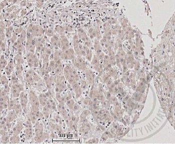 Images provided the Independent Validation Program, badge number 029578:Formalin-fixed and paraffin embedded human liver labeled with Anti-TNFSF9\/CD137L Polyclonal Antibody, Unconjugated (bs-3851R) at 1:200 followed by conjugation to the secondary antibody and DAB staining