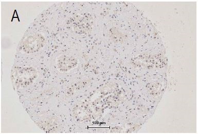 Image provided by the Independent Validation Program, badge number 029577:Formalin-fixed and paraffin embedded human testis labeled with Anti-ZO-1 Polyclonal Antibody, Unconjugated (bs-1329R) at 1:250 followed by conjugation to the secondary antibody.