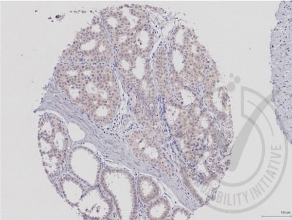 Image provided by the Independent Validation Program, badge number 029644:Formalin-fixed and paraffin embedded human breast myoepithelial and glandular tissue labeled with Anti-MEK5 Polyclonal Antibody, Unconjugated (bs-4124R) at 1:250 followed by conjugation to the secondary antibody and DAB staining