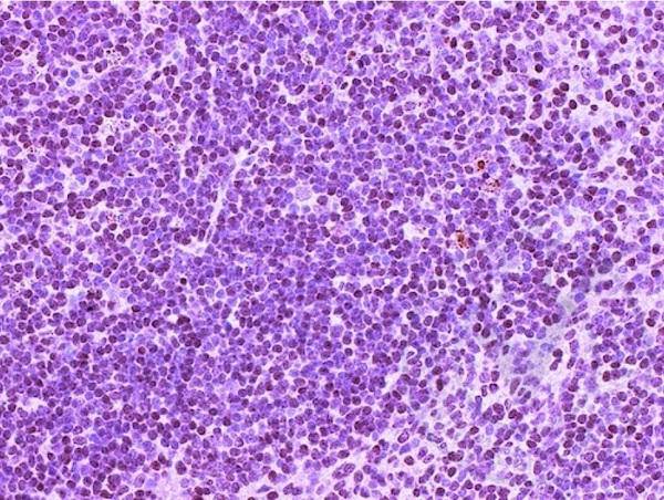 Image provided by the Independent Validation Program, badge number 029634:Formalin-fixed and paraffin embedded mouse spleen labeled with Anti-CD4 Polyclonal Antibody, Unconjugated (bs-0647R) at 1:400 followed by conjugation to the secondary antibody and DAB staining