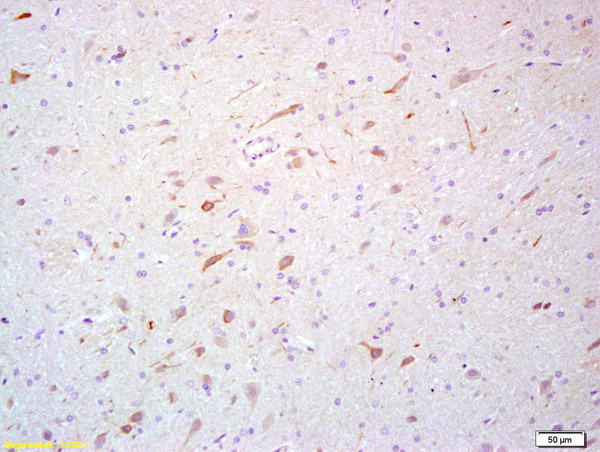 Formalin-fixed and paraffin embedded rat brain labeled with Rabbit Anti- Scavenger receptor class B member 1 Polyclonal Antibody, Unconjugated (bs-1186R) at 1:200 followed by conjugation to the secondary antibody and DAB staining\\n