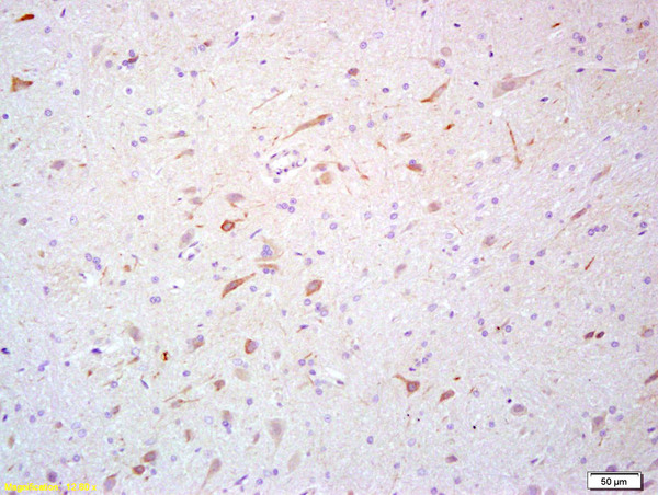 Formalin-fixed and paraffin embedded rat brain labeled with Rabbit Anti- Scavenger receptor class B member 1 Polyclonal Antibody, Unconjugated (bs-1186R) at 1:200 followed by conjugation to the secondary antibody and DAB staining\n