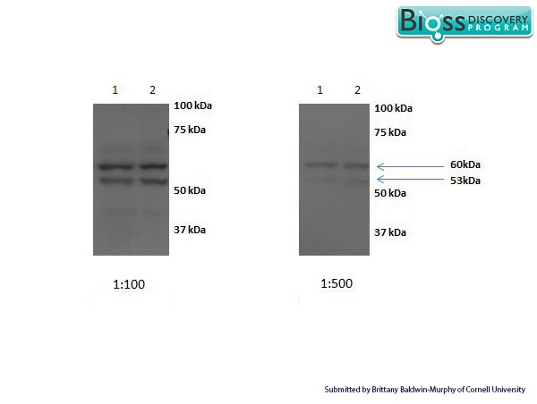 Image kindly submitted by Brittany Baldwin-Murphy from Cornell University.\n\nChick embryo liver hepatocytes probed with Rabbit Anti- Scavenger receptor class B member 1 Polyclonal Antibody at 1:100 or 1:500.\n