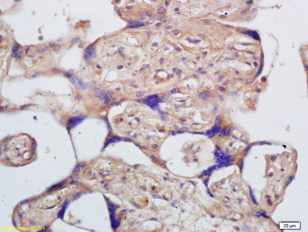 Formalin-fixed and paraffin embedded human placenta labeled with Rabbit Anti Kif14 Polyclonal Antibody, Unconjugated (bs-2494R) at 1:200 followed by conjugation to the secondary antibody and DAB staining