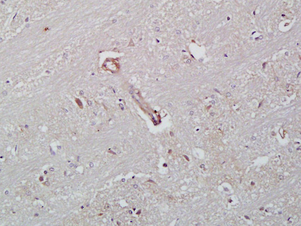 Formalin-fixed and paraffin embedded rat brain labeled with Rabbit Anti-ICAM-2/CD102 Polyclonal Antibody, Unconjugated (bs-1258R) at 1:200 followed by conjugation to the secondary antibody and DAB staining