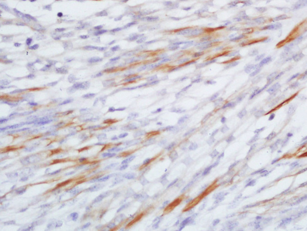 Formalin-fixed and paraffin embedded mouse embryo labeled with Rabbit Anti-CCL20/MIP3 alpha Polyclonal Antibody, Unconjugated (bs-1268R) at 1:200 followed by conjugation to the secondary antibody and DAB staining\n