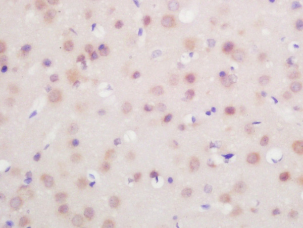 Formalin-fixed and paraffin embedded mouse brain labeled with Rabbit Anti-FoxP1 Polyclonal Antibody, Unconjugated (bs-1275R) at 1:200 followed by conjugation to the secondary antibody and DAB staining\\n