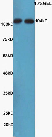 Lane 1: mouse kidney, lysates Lane 2: mouse brain probed with Rabbit Anti-NFkB Inducing Kinase NIK Polyclonal Antibody, Unconjugated (bs-0074R) at 1:200 overnight at 4˚C. Followed by conjugation to secondary antibody (bs-0295G-HRP) at 1:3000 for 90 min at 37˚C.