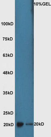 Lane 1: mouse lung lysate Lane 2: mouse brain lysate probed with Rabbit Anti-ATF3 Polyclonal Antibody, Unconjugated (bs-0519R) at 1:300 overnight at 4˚C. Followed by conjugation to secondary antibody (bs-0295G-HRP) at 1:5000 for 90 min at 37˚C.