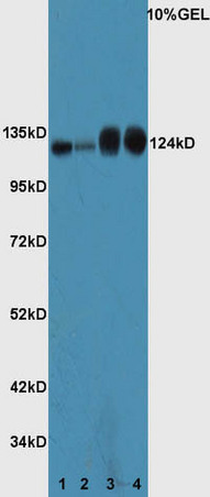 Lane 1: Mouse spleen lysate Lane 2: Mouse thymus lysate Lane 3: Mouse prostate lysate Lane 4: Mouse intestine lysate probed with Rabbit Anti-ASPP2/p53BP2 Polyclonal Antibody, Unconjugated (bs-1283R) at 1:300 overnight at 4˚C. Followed by conjugation to secondary antibody (bs-0295G-HRP) at 1:5000 for 90 min at 37˚C. Lane 1: Mouse spleen lysate Lane 2: Mouse thymus lysate Lane 3: Mouse prostate lysate Lane 4: Mouse intestine lysate probed with Rabbit Anti-ASPP2/p53BP2 Polyclonal Antibody, Unconjugated (bs-1283R) at 1:300 overnight at 4˚C. Followed by conjugation to secondary antibody (bs-0295G-HRP) at 1:5000 for 90 min at 37˚C.