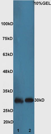 Lane 1:Mouse kidney lysate Lane 2: Mouse brain lysate probed with Rabbit Anti-Bad Polyclonal Antibody, Unconjugated (bs-1304R) at 1:300 overnight at 4˚C. Followed by conjugation to secondary antibody (bs-0295G-HRP) at 1:5000 for 90 min at 37˚C.