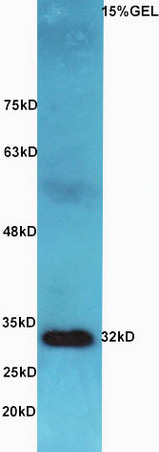 Lane 1: Mouse intestine lysates probed with Rabbit Anti-AQP9 Polyclonal Antibody, Unconjugated (bs-2060R) at 1:300 overnight at 4˚C. Followed by conjugation to secondary antibody (bs-0295G-HRP) at 1:5000 for 90 min at 37˚C.