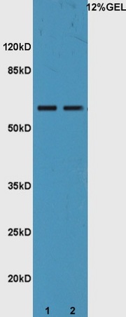 Lane 1: mouse liver lysates Lane 2: mouse intestine probed with Rabbit Anti-IL-22R Polyclonal Antibody, Unconjugated (bs-2624R) at 1:300 overnight at 4˚C. Followed by conjugation to secondary antibody (bs-0295G-HRP) at 1:5000 for 90 min at 37˚C.