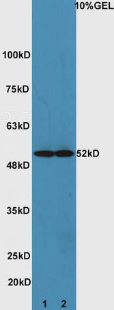 Lane 1: mouse heart lysates Lane 2: mouse brain lysate probed with Rabbit Anti-ATG4D Polyclonal Antibody, Unconjugated (bs-4009R) at 1:300 overnight at 4˚C. Followed by conjugation to secondary antibody (bs-0295G-HRP) at 1:5000 for 90 min at 37˚C.