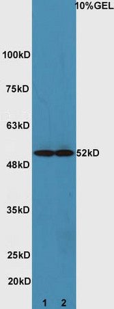 Lane 1: mouse heart lysates Lane 2: mouse brain lysate probed with Rabbit Anti-ATG4D Polyclonal Antibody, Unconjugated (bs-4009R) at 1:300 overnight at 4˚C. Followed by conjugation to secondary antibody (bs-0295G-HRP) at 1:5000 for 90 min at 37˚C. Lane 1: mouse heart lysates Lane 2: mouse brain lysate probed with Rabbit Anti-ATG4D Polyclonal Antibody, Unconjugated (bs-4009R) at 1:300 overnight at 4˚C. Followed by conjugation to secondary antibody (bs-0295G-HRP) at 1:5000 for 90 min at 37˚C.