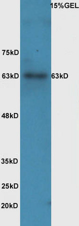 Lane 1: Mouse Intestinal lysate; Probed with IL-1R1 (Tyr496) Polyclonal Antibody, Unconjugated (bs-5394R) at 1:300 overnight at 4˚C. Followed by incubation with conjugated secondary antibody (bs-0295G-HRP) at 1:5000 for 90 min at 37˚C.
