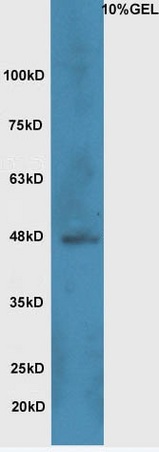 Lane 1:A549 cell lysates probed with Rabbit Anti-Wnt8b Polyclonal Antibody, Unconjugated (bs-6245R) at 1:300 overnight at 4˚C. Followed by conjugation to secondary antibody (bs-0295G-HRP) at 1:5000 for 90 min at 37˚C.