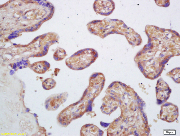 Formalin-fixed and paraffin embedded human placenta labeled with Rabbit Anti PAFAH2/Lp-PLA2 Polyclonal Antibody, Unconjugated (bs-1451R) at 1:200 followed by conjugation to the secondary antibody and DAB staining