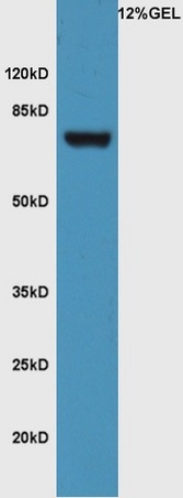 Lane 1: mouse pancreas lysate probed with Rabbit Anti-FZD3/Frizzled 3 Polyclonal Antibody, Unconjugated (bs-13239R) at 1:300 overnight at 4˚C. Followed by conjugation to secondary antibody (bs-0295G-HRP) at 1:5000 for 90 min at 37˚C.
