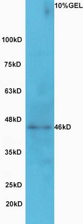 Lane 1: A549 cell lysates probed with Rabbit Anti-GCNT2 Polyclonal Antibody, Unconjugated (bs-13316R) at 1:300 overnight at 4˚C. Followed by conjugation to secondary antibody (bs-0295G-HRP) at 1:5000 for 90 min at 37˚C.