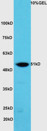 Lane 1:A549 cell lysates probed with Rabbit Anti-hnRNP K Polyclonal Antibody, Unconjugated (bs-4296R) at 1:300 overnight at 4˚C. Followed by conjugation to secondary antibody (bs-0295G-HRP) at 1:5000 for 90 min at 37˚C.