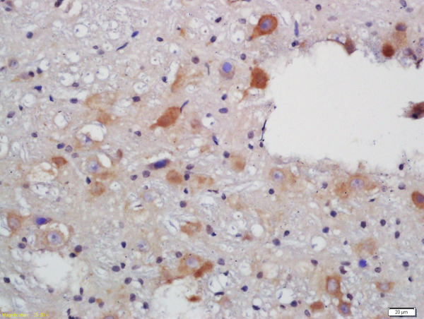 Formalin-fixed and paraffin embedded rat brain labeled with Rabbit Anti-VAT Polyclonal Antibody, Unconjugated (bs-1833R) at 1:200 followed by conjugation to the secondary antibody and DAB staining