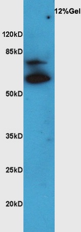 Lane 1: rat brain lysates probed with Rabbit Anti-VAT Polyclonal Antibody, Unconjugated (bs-1833R) at 1:300 overnight at 4˚C. Followed by conjugation to secondary antibody (bs-0295G-HRP) at 1:5000 for 90 min at 37˚C.
