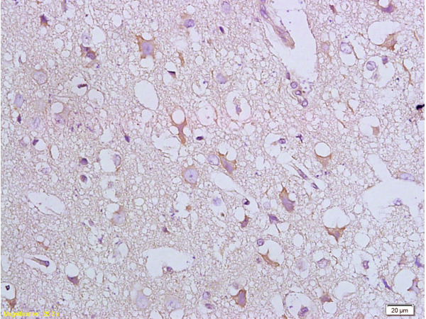 Formalin-fixed and paraffin embedded: rat brain tissue labeled with Anti-Bax Polyclonal Antibody, Unconjugated (bs-0127R) at 1:800 followed by conjugation to the secondary antibody and DAB staining