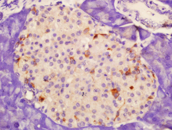 Formalin-fixed and paraffin embedded rat pancreas labeled with Rabbit Anti-CD62p Polyclonal Antibody, Unconjugated (bs-0561R) at 1:200 followed by conjugation to the secondary antibody and DAB staining