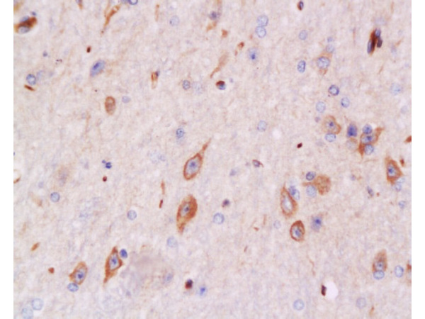 Formalin-fixed and paraffin embedded rabbit brain tissue labeled with Anti-Bax Polyclonal Antibody, Unconjugated (bs-0127R) at 1:200 followed by conjugation to the secondary antibody and DAB staining