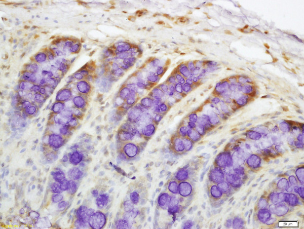 Formalin-fixed and paraffin embedded rat colon labeled with Rabbit Anti-DR4 Polyclonal Antibody, Unconjugated (bs-0591R) at 1:200 followed by conjugation to the secondary antibody and DAB staining\n