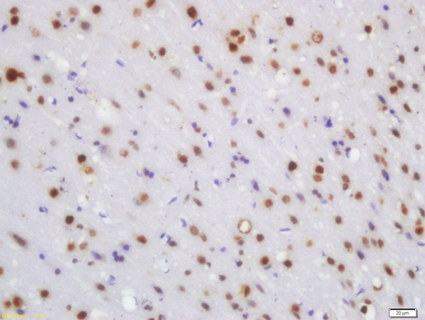 Formalin-fixed and paraffin embedded rat brain labeled with Rabbit Anti-WRB Polyclonal Antibody, Unconjugated (bs-11774R) at 1:200 followed by conjugation to the secondary antibody and DAB staining