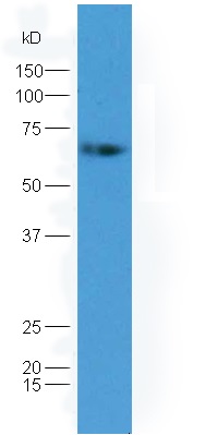 Lane 1: mouse embryo lysates probed with Rabbit Anti-GAD65 + GAD67 Polyclonal Antibody, Unconjugated (bs-13263R) at 1:300 overnight at 4˚C. Followed by conjugation to secondary antibody (bs-0295G-HRP) at 1:5000 for 90 min at 37˚C.