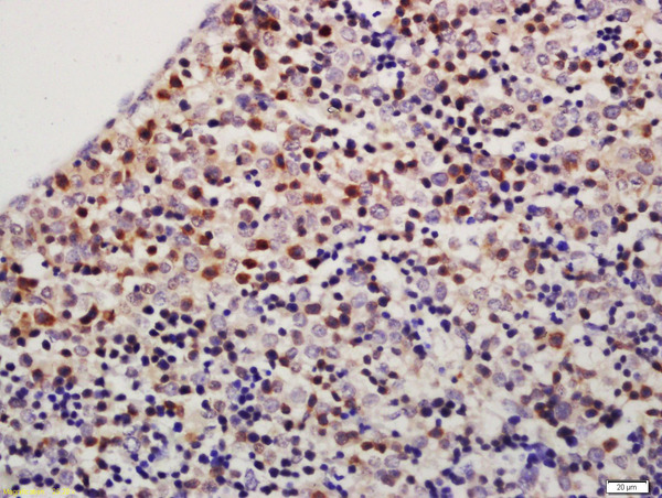 Formalin-fixed and paraffin embedded mouse fetal liver labeled with Rabbit Anti-TXNDC9 Polyclonal Antibody, Unconjugated (bs-9429R) at 1:200 followed by conjugation to the secondary antibody and DAB staining