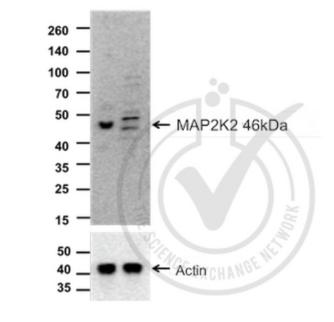Images provided by the Independent Validation Program, badge number 029748. Lane one: HeLa cell lysates. Lane 2: c6\/36 Mosquito cell extract (non-reactive\\nspecies) probed with Rabbit Anti-MEK2 Polyclonal Antibody, Unconjugated (bs-0223R) at 1:100 overnight at 4˚C. Followed by conjugation to secondary antibody at 1:20000 for 60 min at 26˚C.