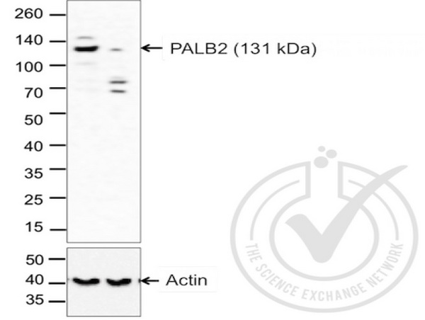 Images provided by the Independent Validation Program (badge number 29749). Lane 1: A549 cell extract Lane 2: c6/36 mosquito cell extract (non-reactive\nspecies) probed with Rabbit Anti-PALB2 Polyclonal Antibody, Unconjugated (bs-0588R) at 1:500 overnight at 4˚C. Followed by conjugation to secondary antibody at 1:20000 for 60 min at 26˚C.