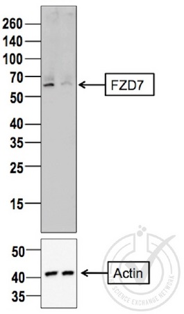 Image provided by the Independent Validation Program (badge number 29805). Lane 1: MDA-MB-231 cell extract, Lane 2: c6/36 mosquito cell extract (non-reactivenspecies) probed with Rabbit Anti-Frizzled 7 Polyclonal Antibody, Unconjugated (bs-5125R) at 1:100 overnight at 4°C. Followed by conjugation to secondary antibody at 1:10000 for 60 min at 26°C. n