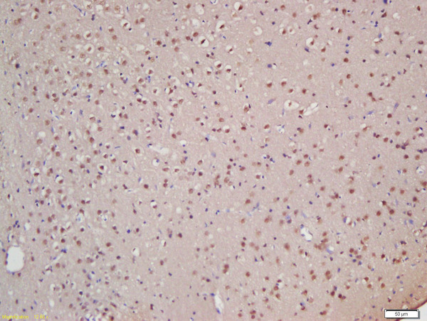 Formalin-fixed and paraffin embedded rat brain labeled with Rabbit Anti-XPB Polyclonal Antibody, Unconjugated (bs-4260R) at 1:200 followed by conjugation to the secondary antibody and DAB staining\n