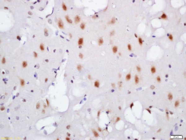 Formalin-fixed and paraffin-embedded mouse brain labeled with Rabbit Anti-TNIK (Ser764) Polyclonal Antibody, Unconjugated (bs-5598R) at 1:200 followed by conjugation to the secondary antibody and DAB staining.