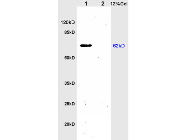 L1 rat brain lysates L2 rat kidney lysates probed with Anti IL-1R1/CD121a/IL1 Receptor I Polyclonal Antibody, Unconjugated (bs-2594R) at 1:200 overnight at 4˚C. Followed by conjugation to secondary antibody (bs-0295G-HRP) at 1:3000 for 90 min at 37˚C. Predicted band 62kD. Observed band size:62kD.