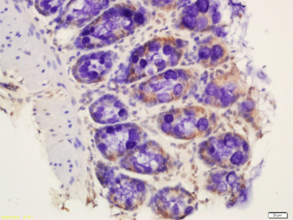 Formalin-fixed and paraffin embedded rat colon labeled with Rabbit Anti-RNA polymerase II CTD repeat YSPTSPS (Ser2) Polyclonal Antibody, Unconjugated (bs-6581R) at 1:200 followed by conjugation to the secondary antibody and DAB staining