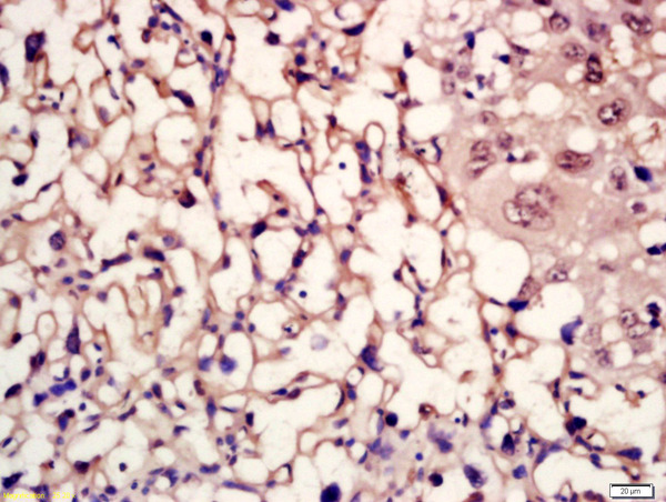 Formalin-fixed and paraffin embedded mouse placenta labeled with Rabbit Anti-MC5 Receptor/MC5-R Polyclonal Antibody, Unconjugated (bs-11418R) at 1:200 followed by conjugation to the secondary antibody and DAB staining