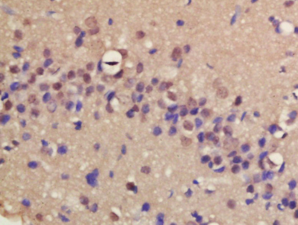Formalin-fixed and paraffin embedded rat brain labeled with Rabbit Anti-ERCC8/CSA Polyclonal Antibody, Unconjugated (bs-13095R) at 1:200 followed by conjugation to the secondary antibody and DAB staining