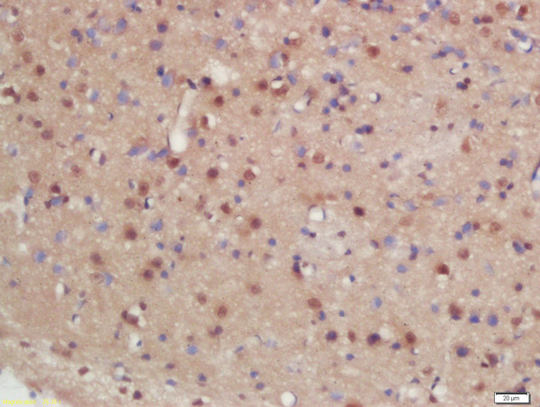 Formalin-fixed and paraffin embedded rat brain labeled with Rabbit Anti-hHR23b Polyclonal Antibody, Unconjugated (bs-15482R) at 1:200 followed by conjugation to the secondary antibody and DAB staining\n