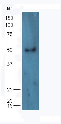 Lane 1: Raji lysates probed with Rabbit Anti-hHR23b Polyclonal Antibody, Unconjugated (bs-15482R) at 1:300 overnight at 4˚C. Followed by conjugation to secondary antibody (bs-0295G-HRP) at 1:5000 for 90 min at 37˚C.