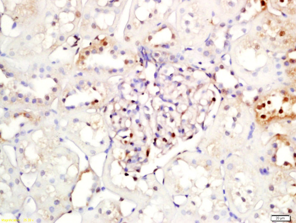 Formalin-fixed and paraffin embedded rat kidney labeled with Rabbit Anti-NFKBIA\/IKB alpha Polyclonal Antibody, Unconjugated (bs-1287R) at 1:200 followed by conjugation to the secondary antibody and DAB staining\\n