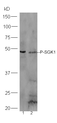 Lane 1:A431 lysates Lane 2: Mouse stomach probed with Rabbit Anti-SGK1 (Ser78) Polyclonal Antibody, Unconjugated (bs-3395R) at 1:300 overnight at 4˚C. Followed by conjugation to secondary antibody (bs-0295G-HRP) at 1:5000 for 90 min at 37˚C.