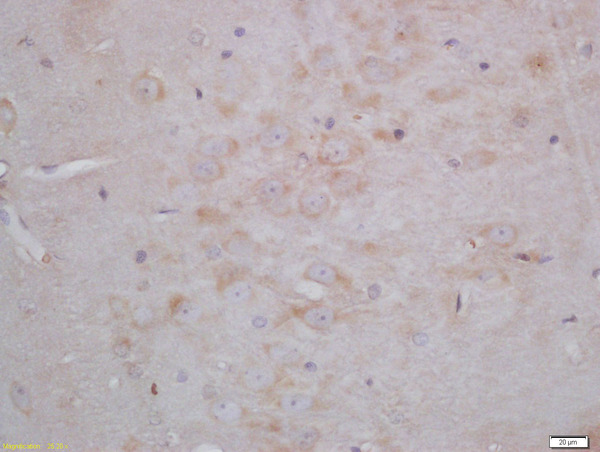Formalin-fixed and paraffin embedded rat brain tissue labeled with Anti-Neurogranin Polyclonal Antibody, Unconjugated(bs-11435R) 1:200, followed by conjugation to the secondary antibody and DAB.